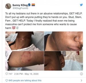 Lesbian Lady Reveals What Her Abusive Girlfriend Did To Her (Photos)